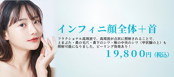 インフィニハイブリッドバナー