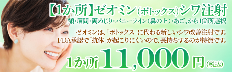 ゼオミンバナー