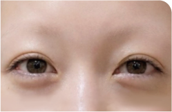 マシンパウダー Before