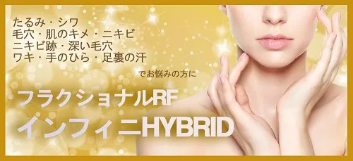 インフィニハイブリッドバナー