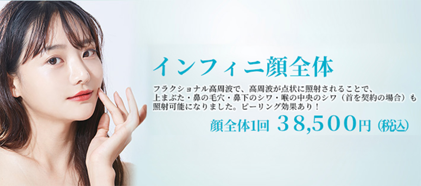 インフィニハイブリッドバナー
