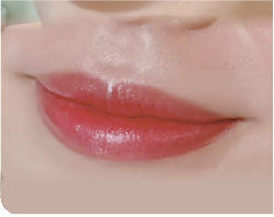 フルリップ After