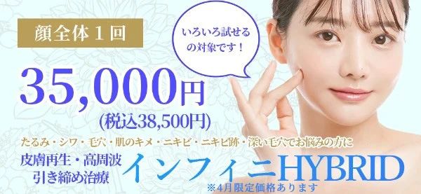 インフィニハイブリッドバナー