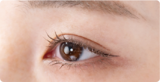 アイライン施術例