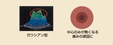 今までの脱毛機