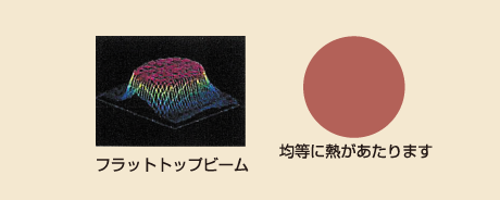 クラリティ脱毛