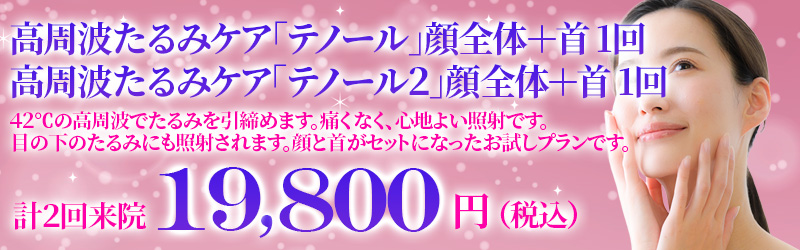 テノールバナー